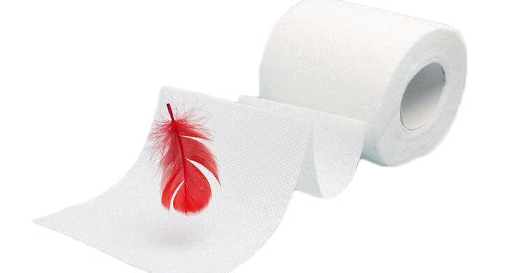 Hämorrhoiden sind eine sehr häufige Erkrankung